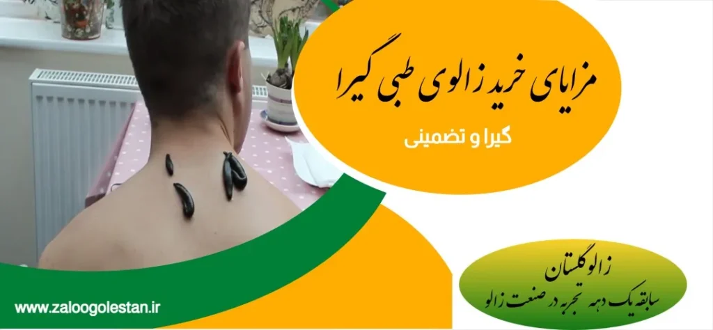 خرید زالوی طبی